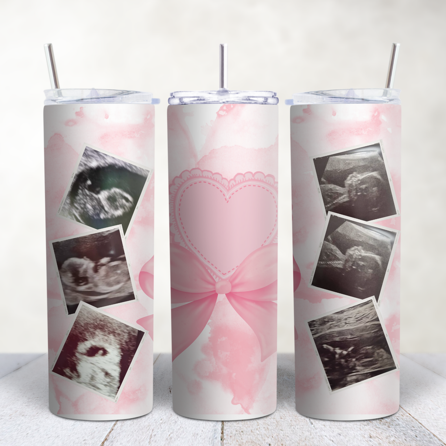 Three tumblers with ultrasound images and a pink butterfly design on a white background